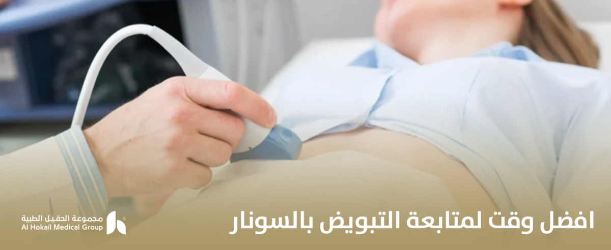 افضل-وقت-لمتابعة-التبويض-بالسونار-1-1200x492.png