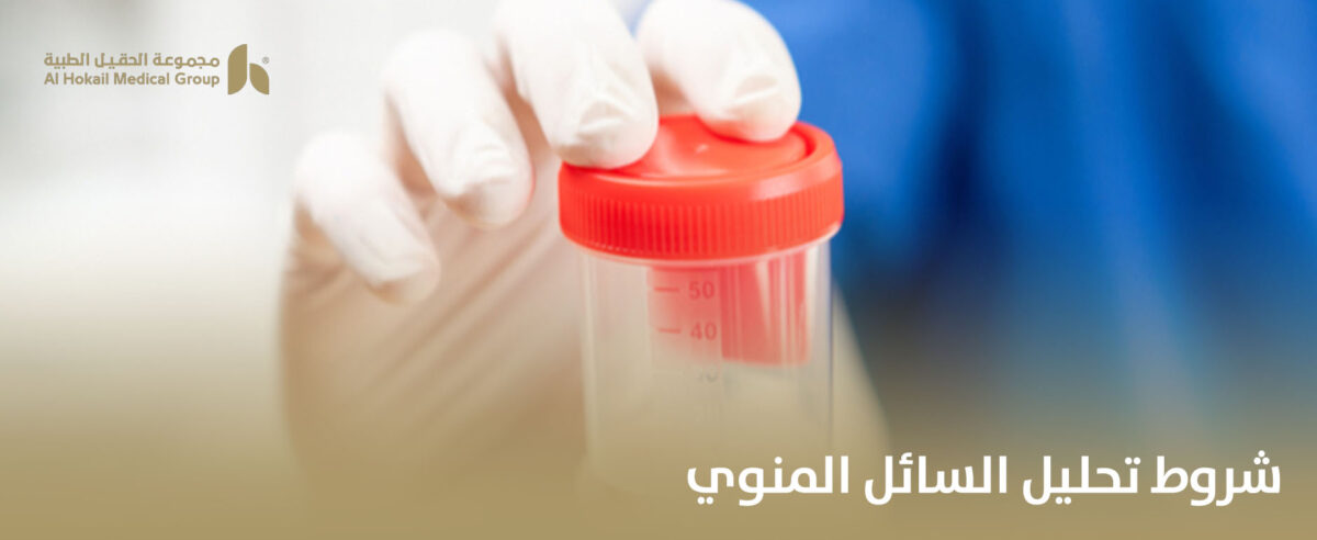 شروط-تحليل-السائل-المنوي-1-1200x492.jpg