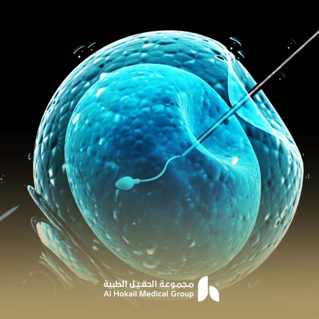 أسعار الحقن المجهري في الدمام والعوامل المؤثرة في التكلفة 1 أسعار الحقن المجهري في الدمام