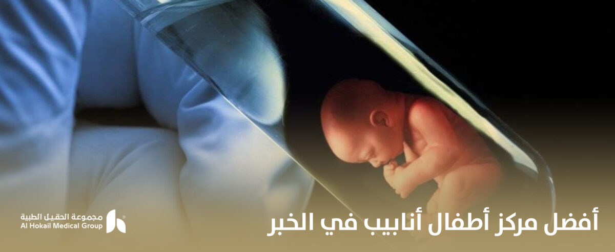 أفضل-مركز-أطفال-أنابيب-في-الخبر-1-1200x492.jpg