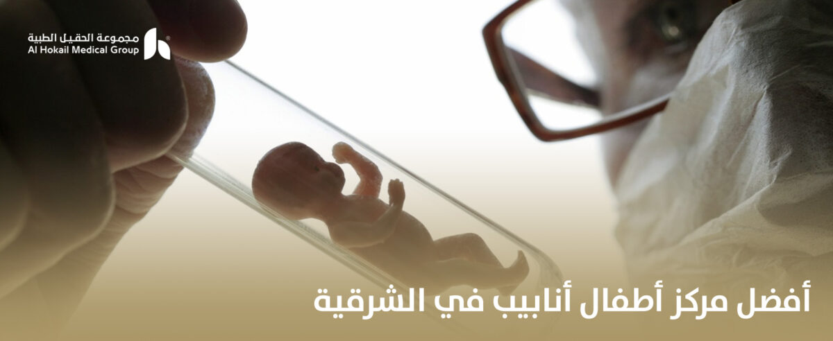 أفضل-مركز-أطفال-أنابيب-في-الشرقية-1-1200x492.jpg