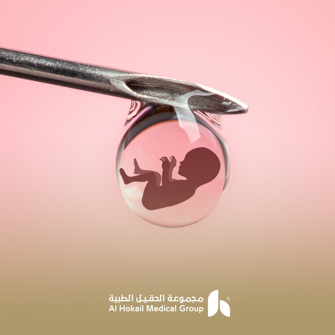تكلفة التلقيح الصناعي في الخبر: دليل التخطيط للعلاج 1 تكلفة التلقيح الصناعي في الخبر