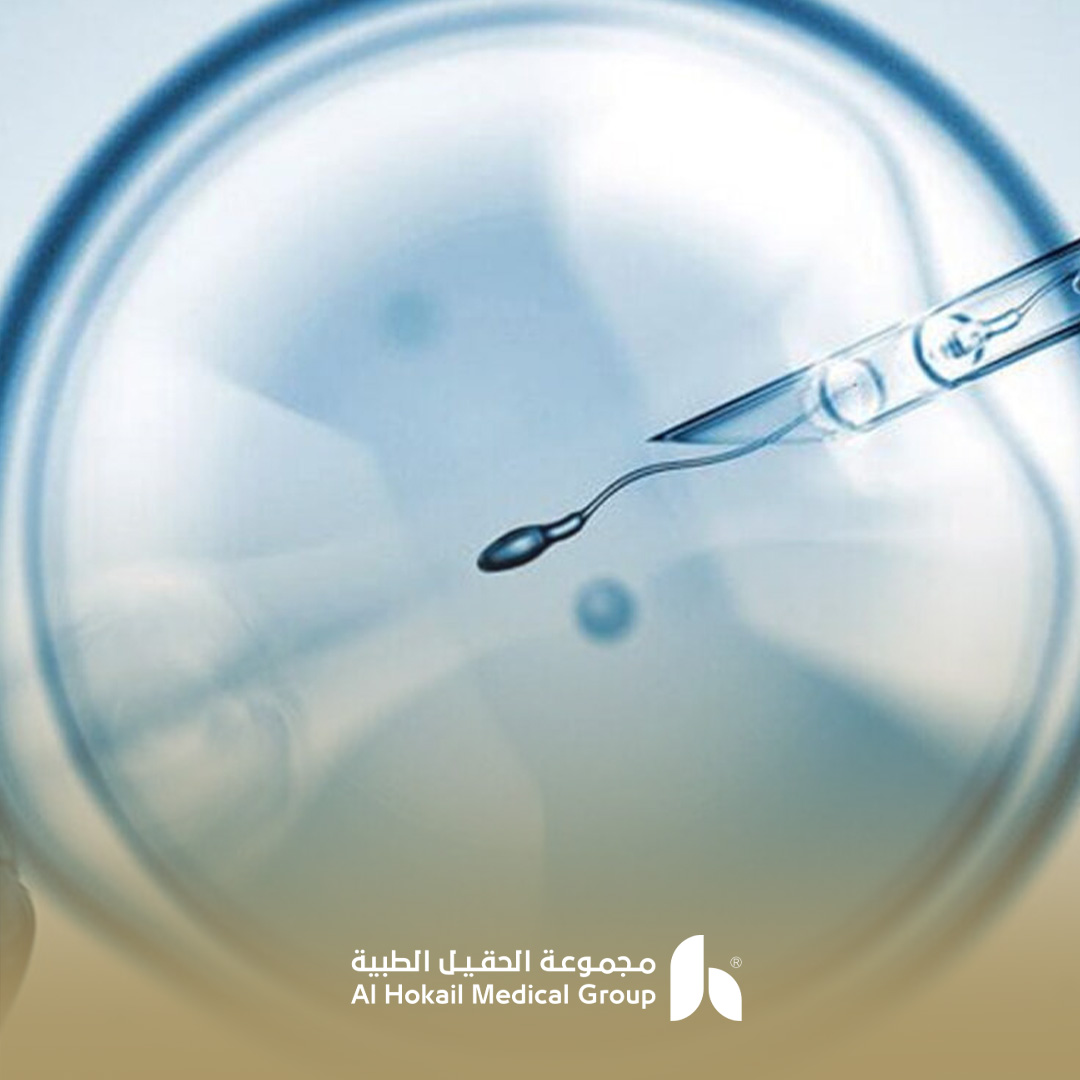 تكلفة الحقن المجهري في الخبر: العوامل والخدمات المشمولة نسخ 1 تكلفة الحقن المجهري في الخبر