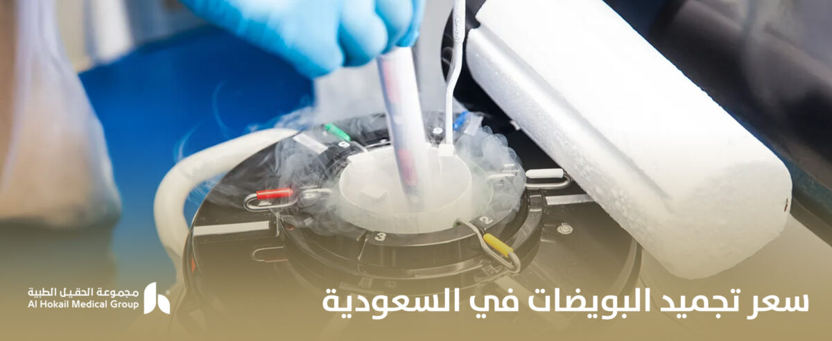 سعر-تجميد-البويضات-في-السعودية-1-1200x492.jpg