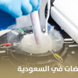 سعر تجميد البويضات في السعودية
